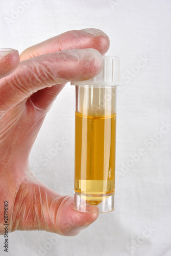 eine Urinprobe in einer Probenflasche photo