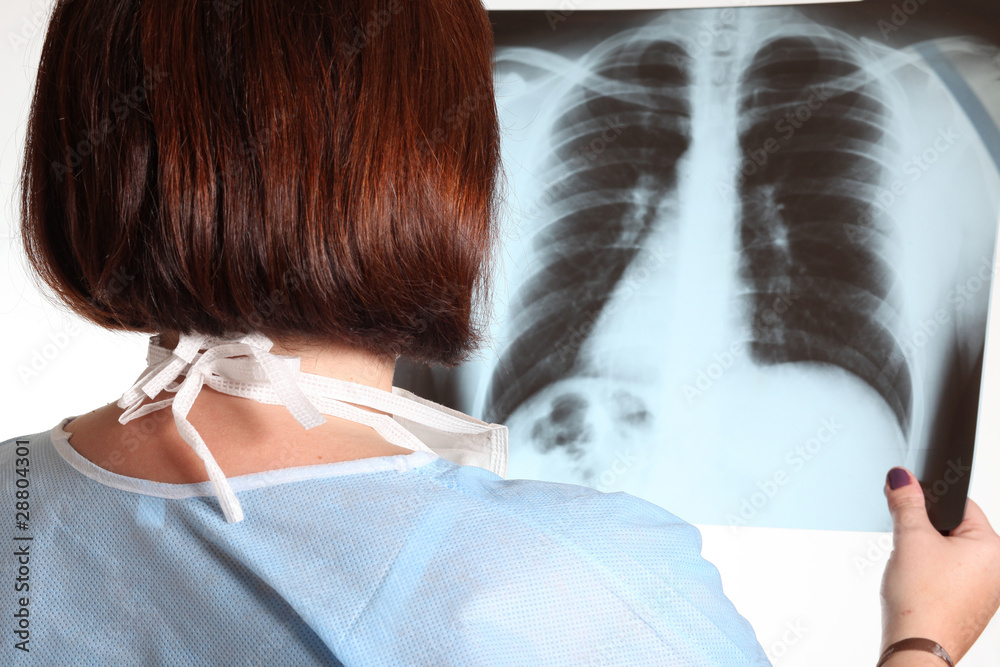 donna medico osserva una radiografia - obrazy, fototapety, plakaty 