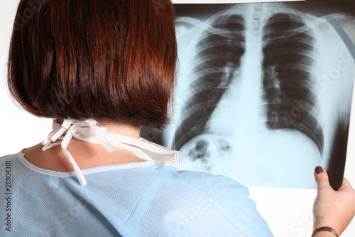 donna medico osserva una radiografia photo