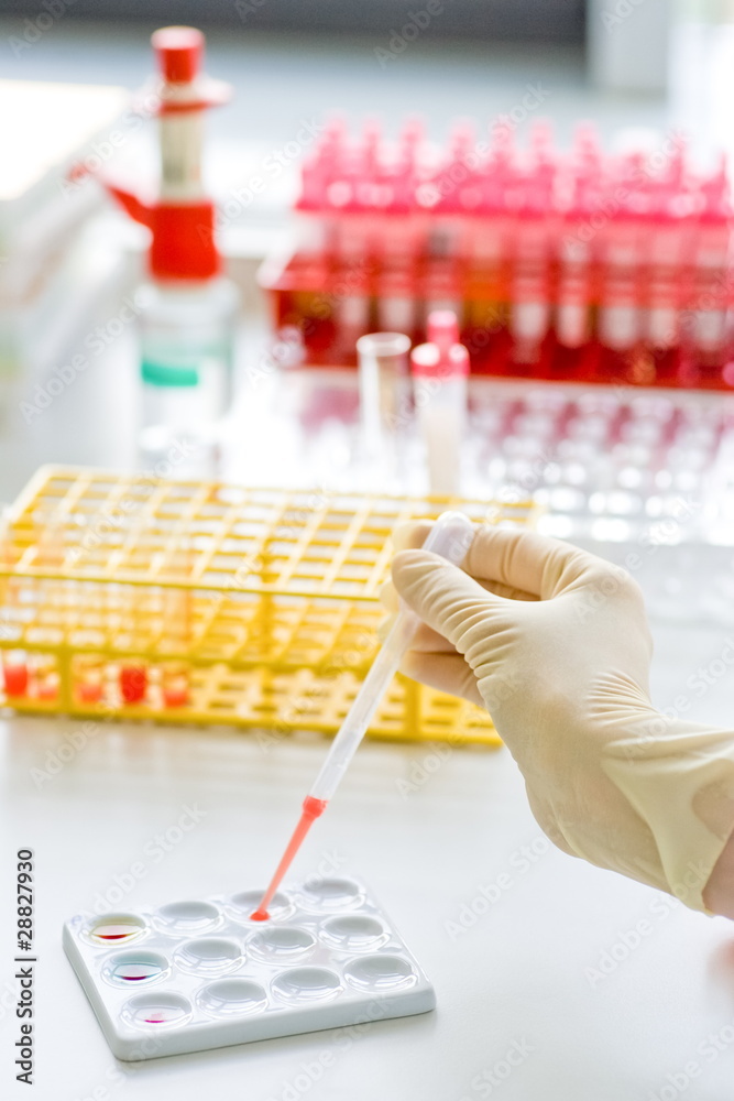 Medizin Gen Probe Doping Labor Medizin Gen Probe Doping Labor