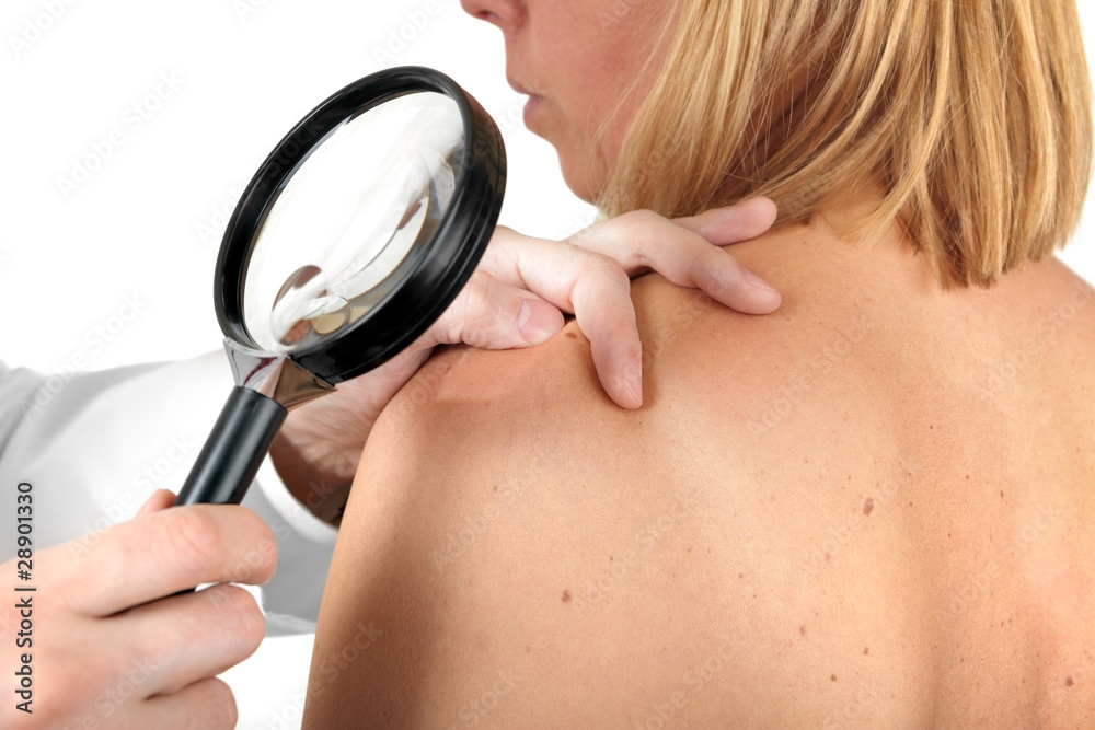 Vorsorgeuntersuchung beim Hautarzt Stock-Foto | Adobe Stock