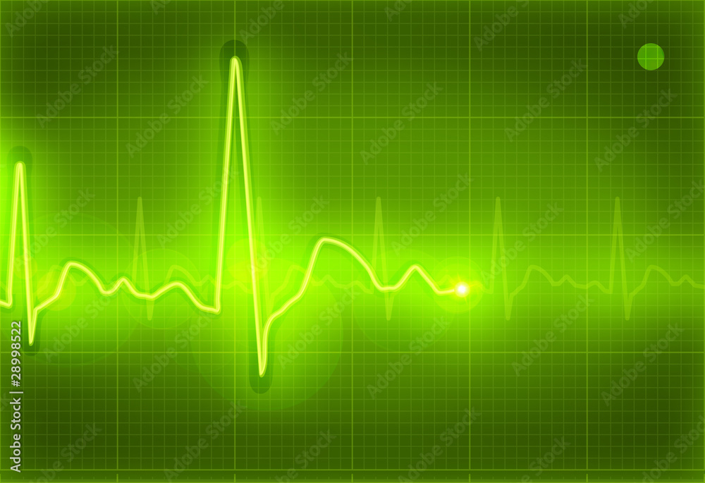 Electrocardiogram green