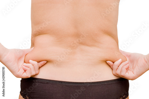 girl with a cellulitis on a stomach photo