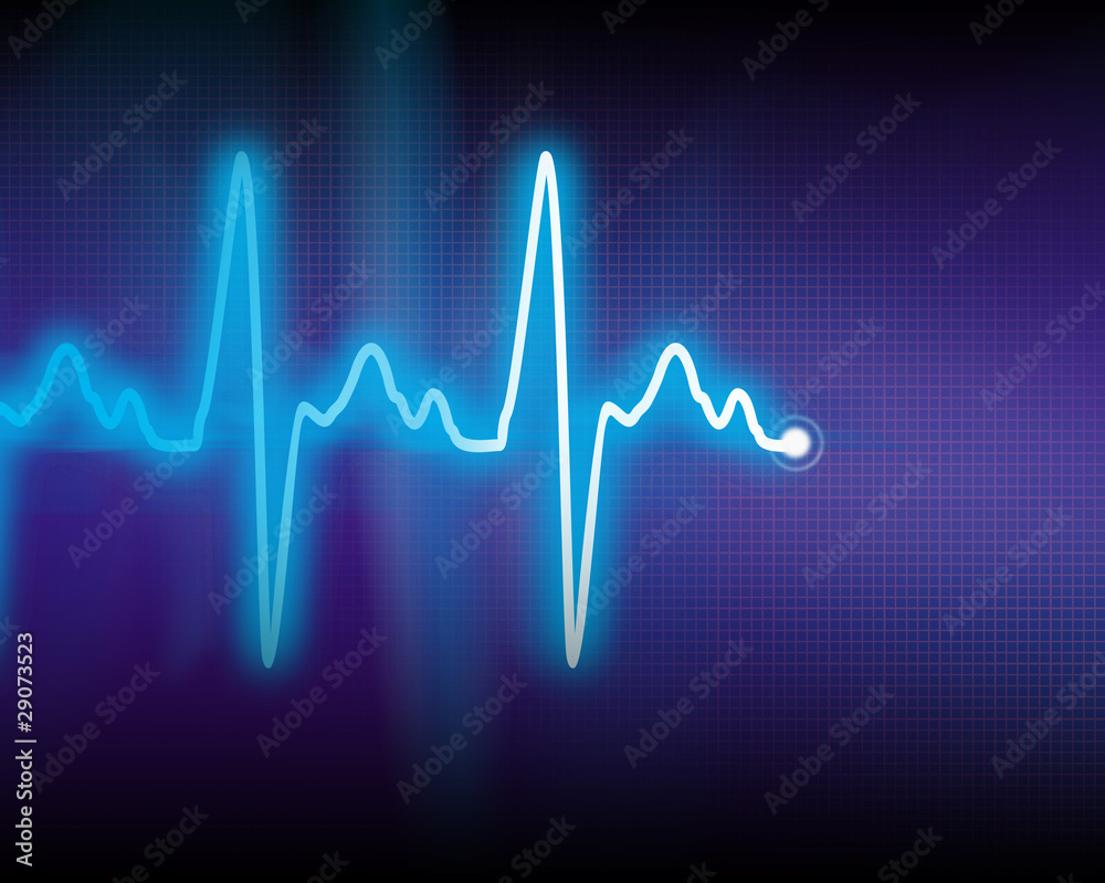 cardiogram cardiogram