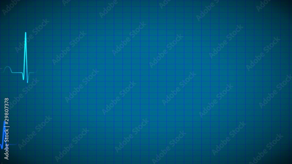 EKG ECG Display background loop EKG ECG Display background loop