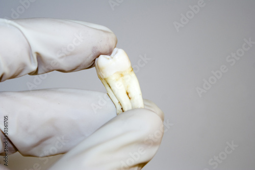 Human tooth