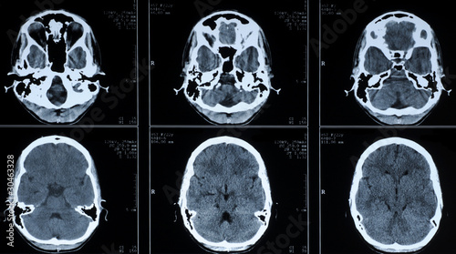 Obraz na płótnie CT photography of human brain w salonie