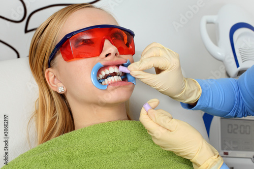 Fototapeta Naklejka Na Ścianę i Meble -  During the process of teeth whitening