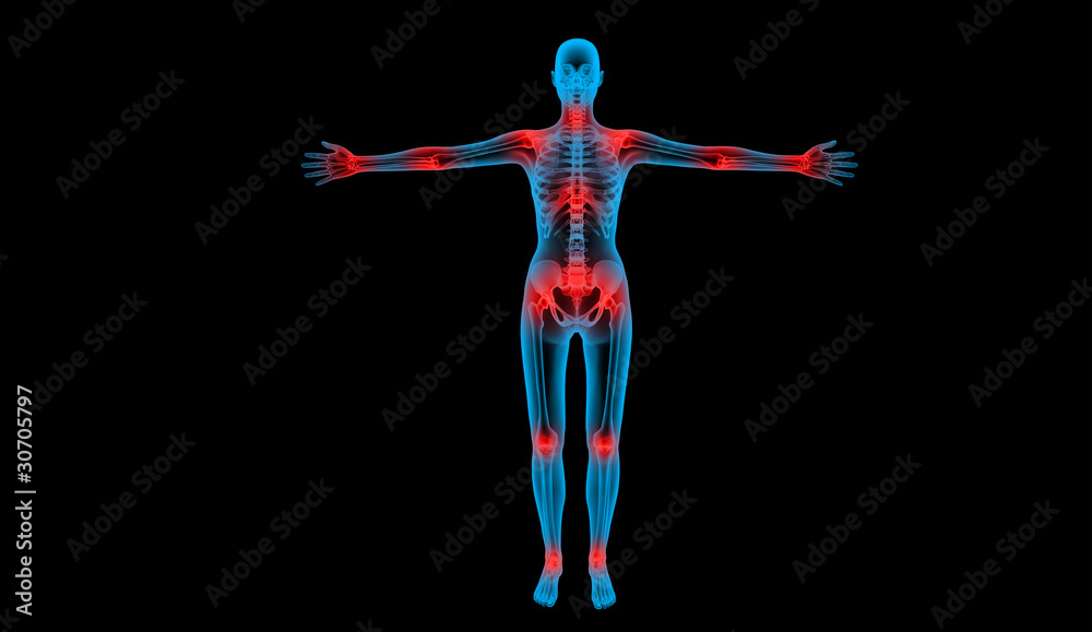 painful joints x-ray body human painful joints x-ray body human