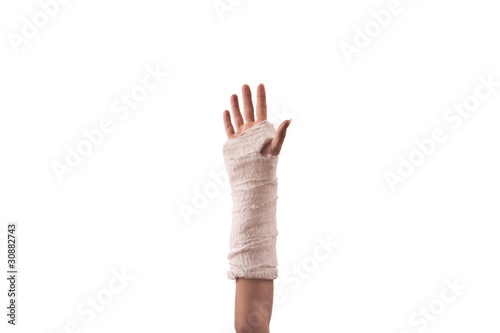 broken hand