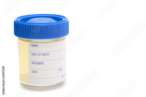 urine sample © Stephen Gibson