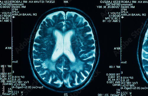 Wallpaper Mural sharp ct scan of the human brain Torontodigital.ca