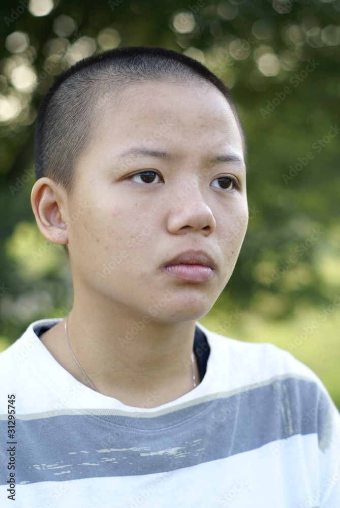 Depressed Asian Teen Girl With Shaved Bald Head Stock Foto Adobe Stock