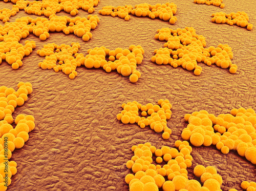 Bacteria staphylococcus infection photo