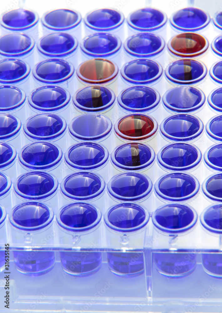 Mikrotiter Platte für medizinische Tests im Labor Stock Photo