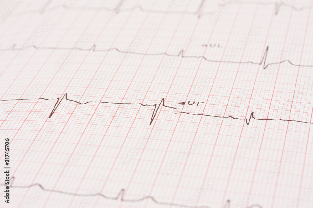 Detail of an electrocardiogram Detail of an electrocardiogram