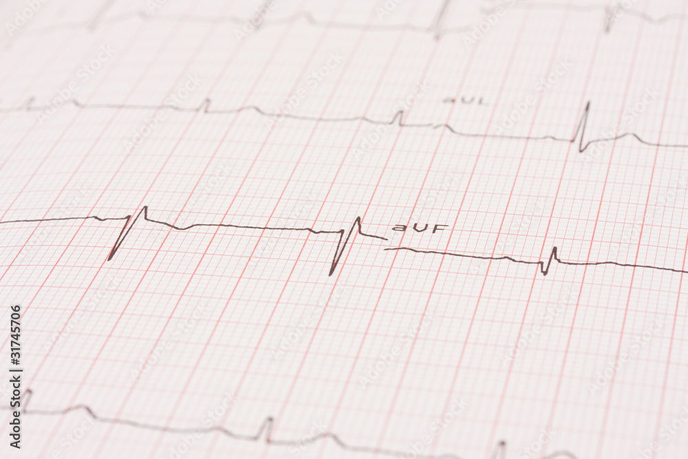 Detail of an electrocardiogram