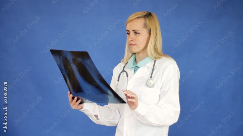 Female doctor looking at xray of human lungs on blue background Female doctor looking at xray of human lungs on blue background