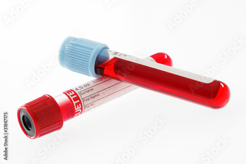 Laboratoire d'analyse médicale-tubes à hémolyse