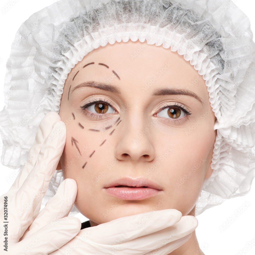 Correction lines on woman face, before surgery operetion Correction lines on woman face, before surgery operetion