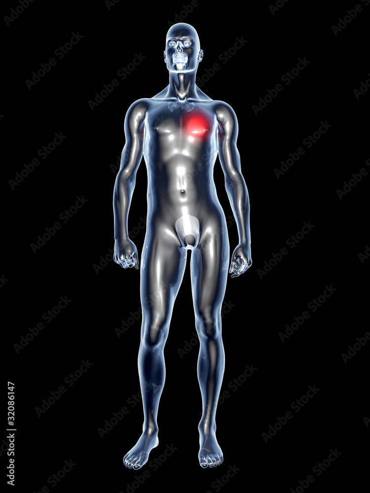 Herzerkrankung - Anatomie