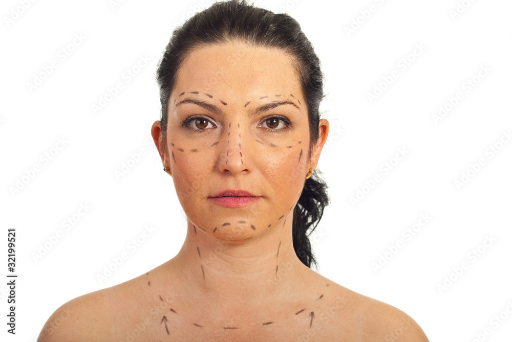 Woman face prepared for plastic surgery Woman face prepared for plastic surgery