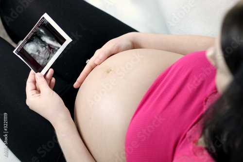 Pregnant woman with ultrasound photo