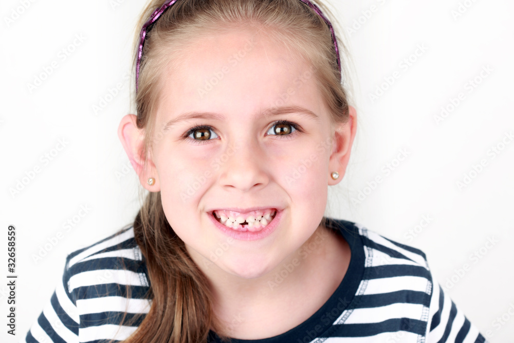First missing tooth First missing tooth