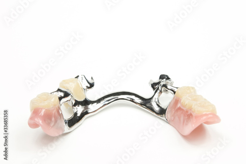 Unterkiefer Teilprothese Zahnersatz