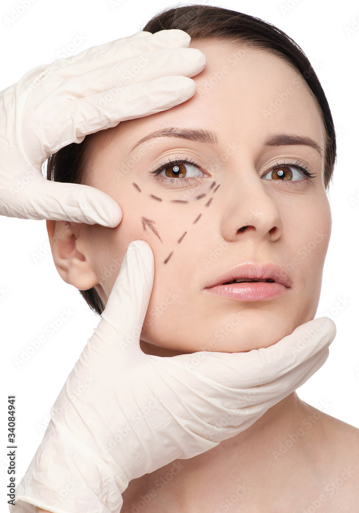 Correction lines on woman face, before surgery operetion
