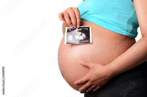 Pregnant woman holding ultrasound scan