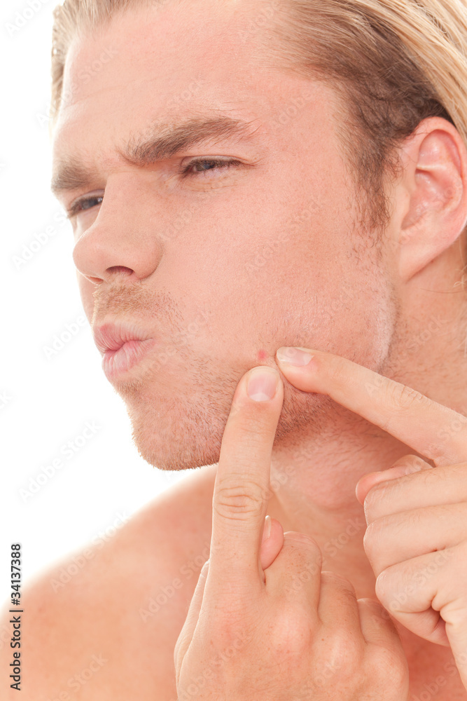 Fototapeta premium pickel im gesicht