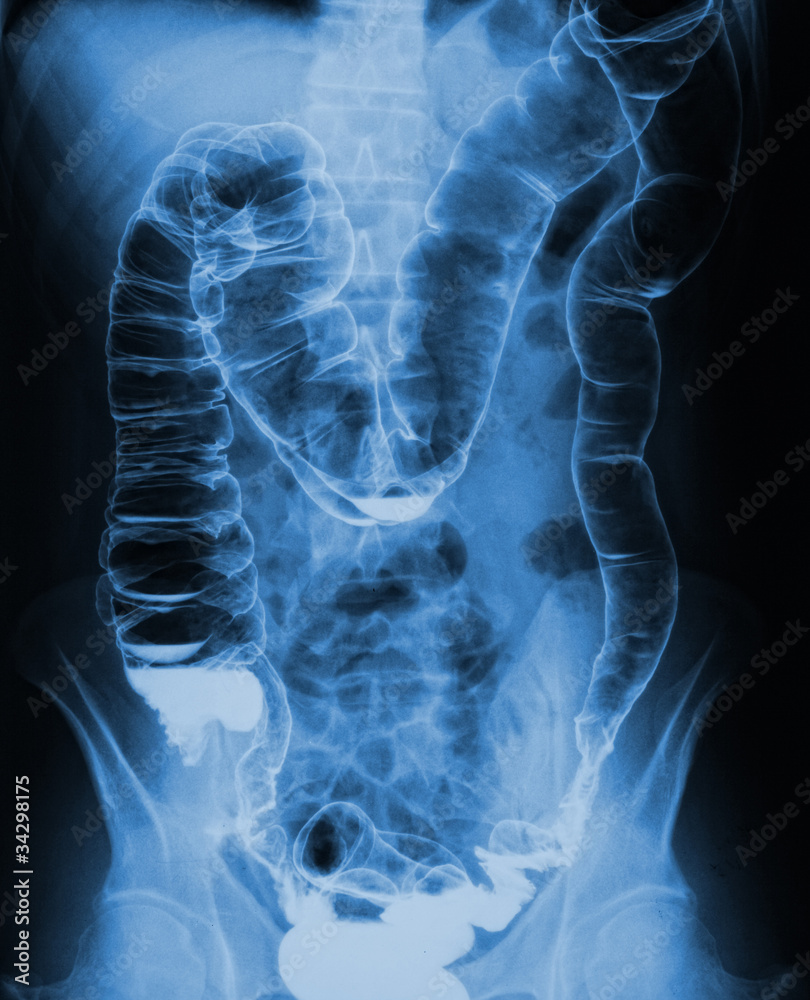 torso xray torso xray