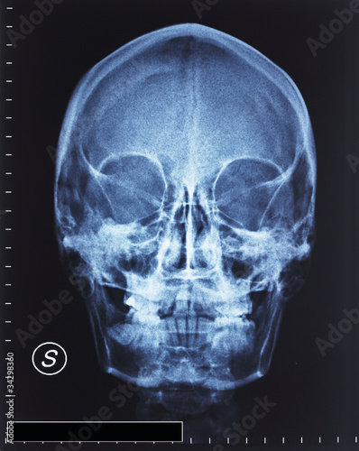 Obraz na płótnie skull xray