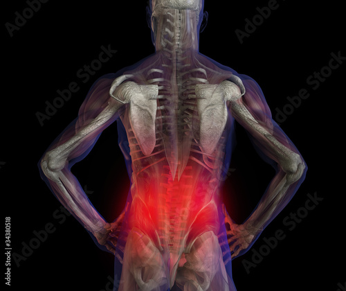 X-ray illustration of male human lower back pain pain.