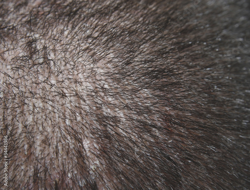 head
