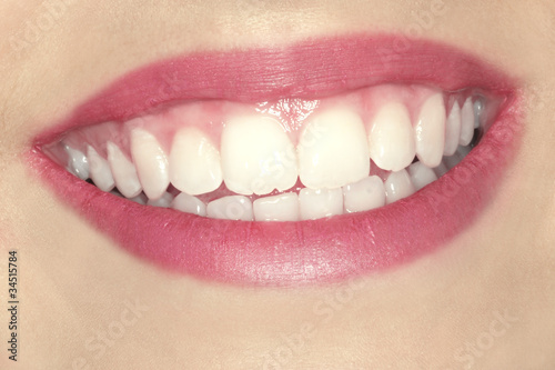 Strahlend weiße Zähne
