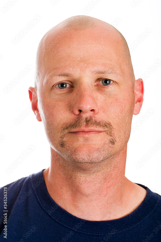 Bald Man Bald Man