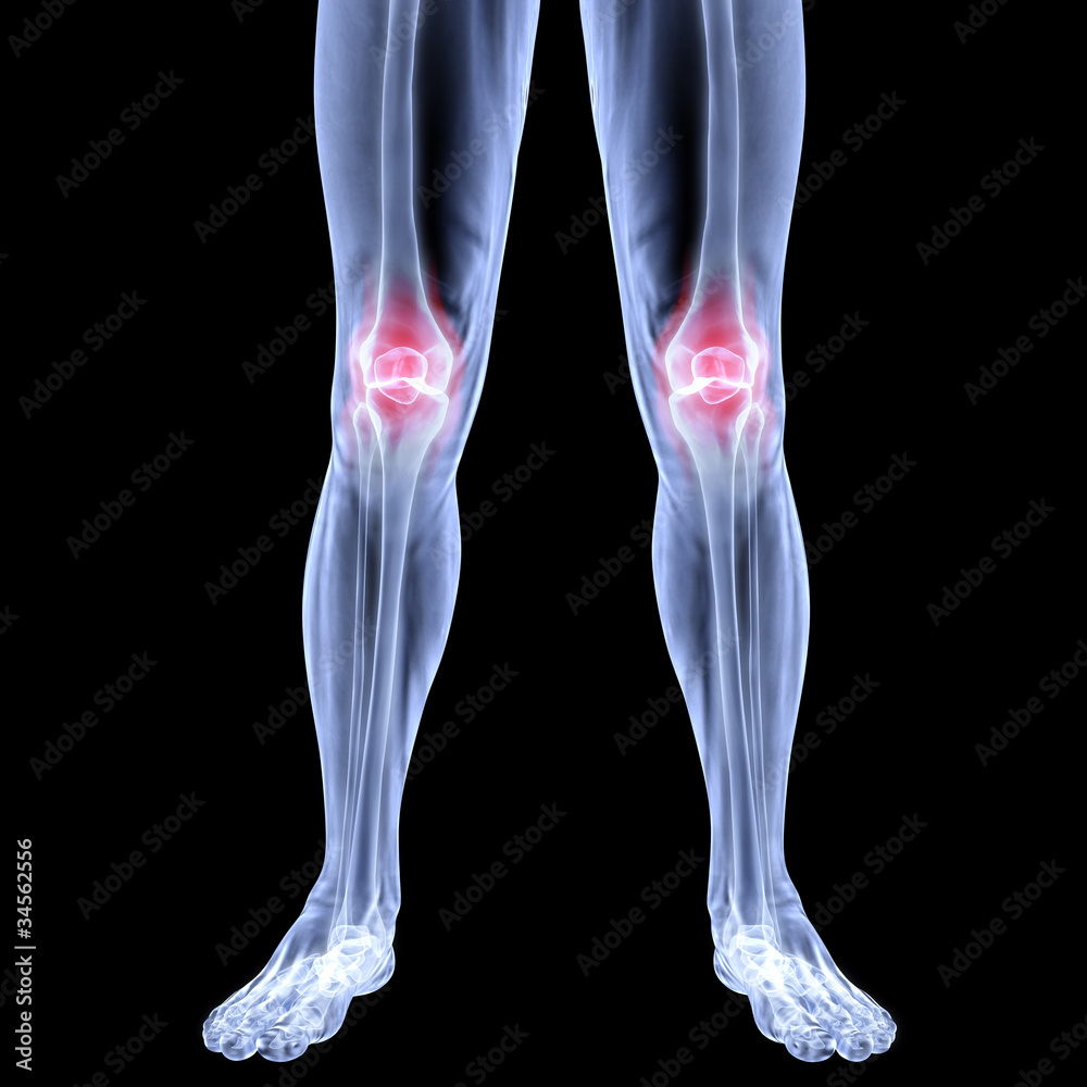 leg