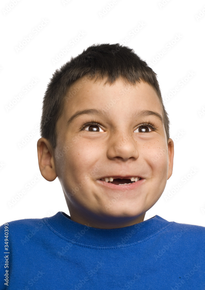 Lost two front teeth Lost two front teeth