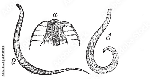 Pinworm or Threadworm or Seatworm or Enterobius vermicularis, vi
