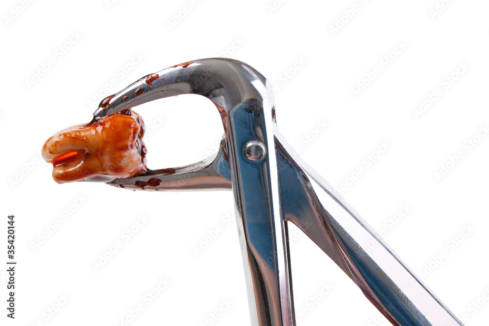 Wisdom tooth and dentist extraction forceps