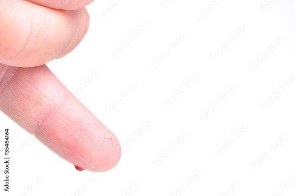 blood dripping from pricked finger isolated blood dripping from pricked finger isolated