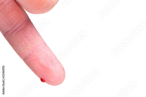 finger dripping blood on white