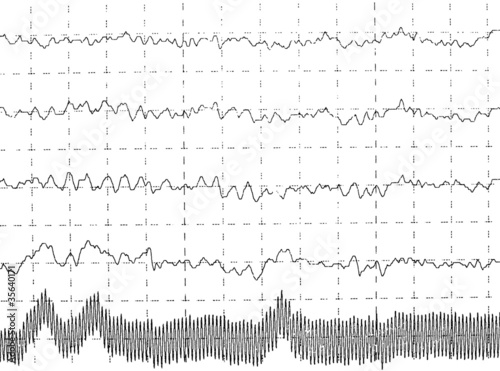 graph brain wave EEG isolated on white background photo