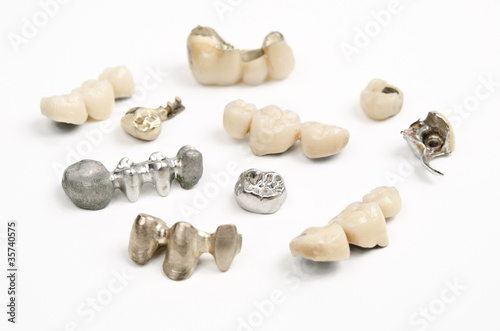 Sortiment Kronen und Brücken, Zahntechnik