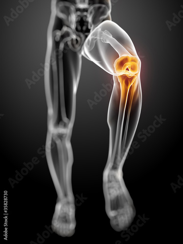 3d rendered anatomy illustration - painful knee