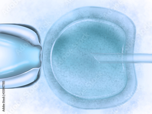 Künstliche Befruchtung - In-Vitro-Fertilisation