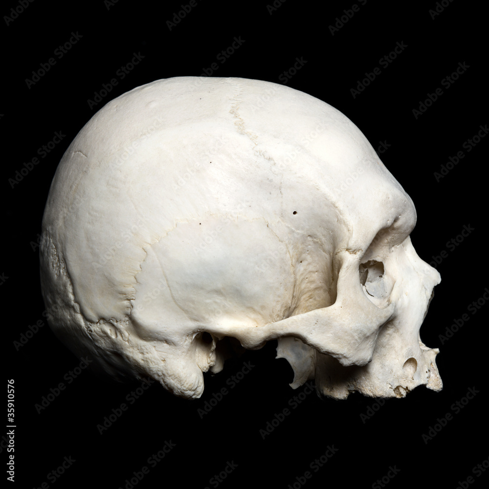 Upper half of the real human Skull Upper half of the real human Skull