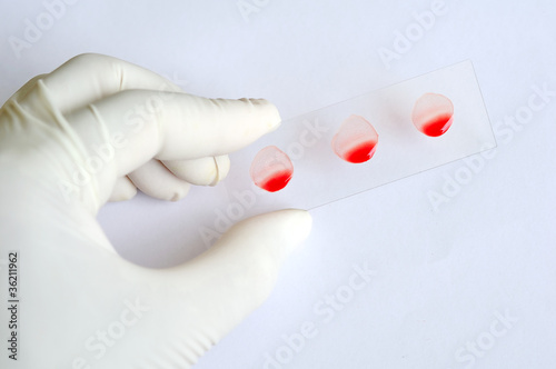 Blood slide